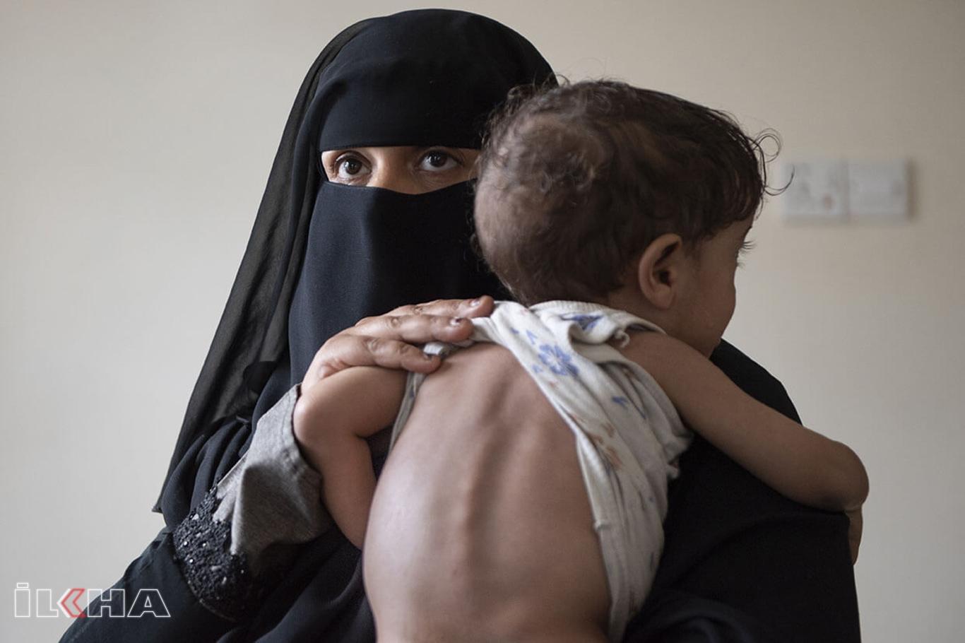 World Health Organization warns for Yemen